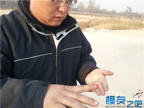 玩模型需谨慎！血的教训！（外伤处置视频晕血者慎入。... 模型,晕血的人多吗,外伤怎么处理,晕血后怎么办 作者:飞天狼 5602 